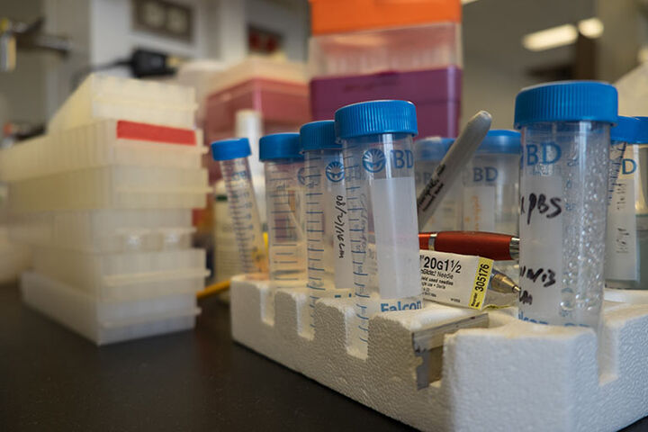 A set of test tubes sitting on a lab bench.